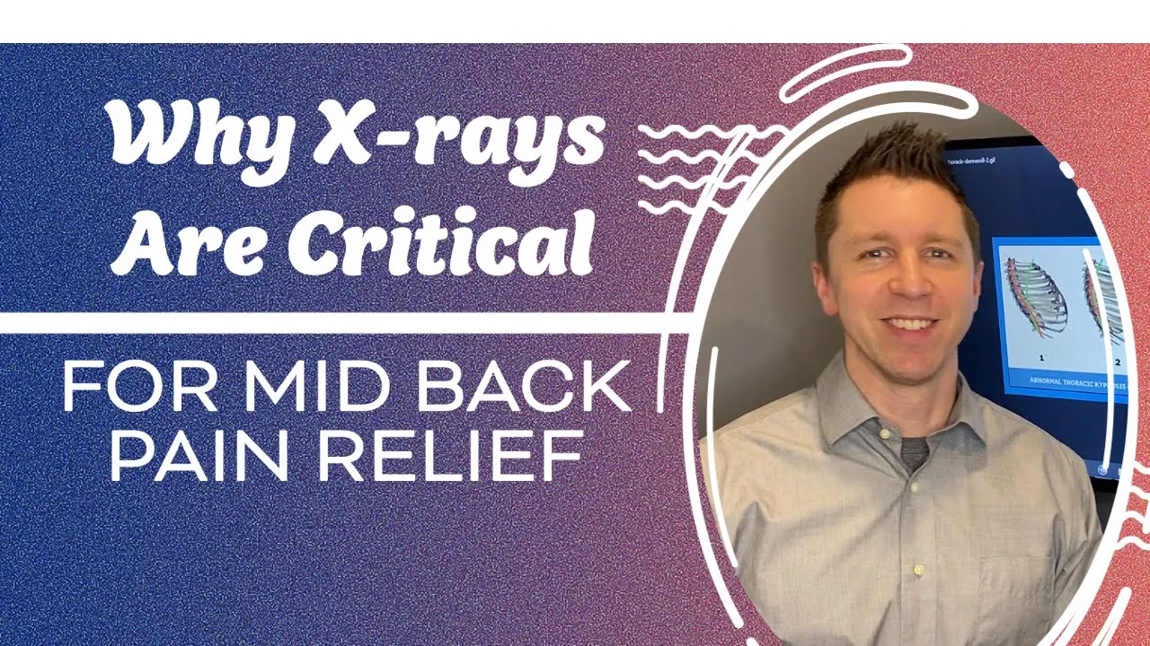 X rays Are Critical for Mid Back Pain Chiropractor in Sun Prairie, WI